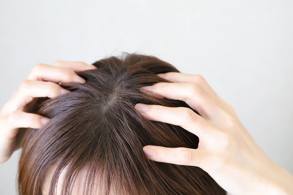 髪が細くなり、トップのボリュームが無くなる